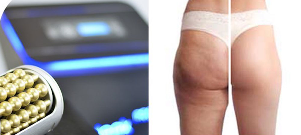 Lymphatic-Drainage near you